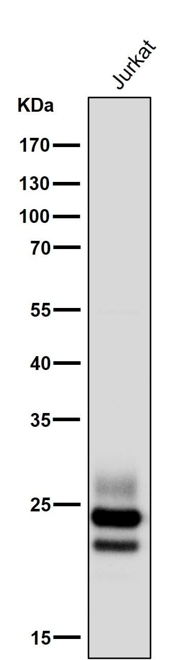 Anti-CD3G Rabbit Monoclonal Antibody Boster Bio