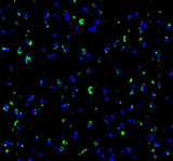 Anti-SynGAP Rabbit Monoclonal Antibody Boster Bio
