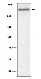 Anti-Versican Rabbit Monoclonal Antibody Boster Bio