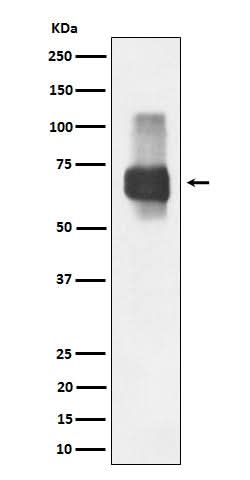 Anti-CD84 Rabbit Monoclonal Antibody Boster Bio