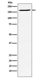 Anti-SMC4 Rabbit Monoclonal Antibody Boster Bio