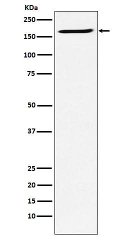 Anti-SMC4 Rabbit Monoclonal Antibody Boster Bio