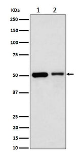 Anti-Annexin A7 Rabbit Monoclonal Antibody Boster Bio