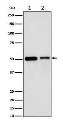 Anti-Annexin A7 Rabbit Monoclonal Antibody Boster Bio