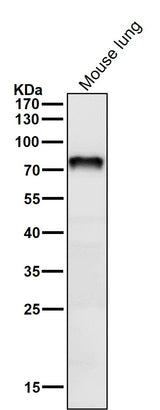 Anti-Netrin 1 NTN1 Monoclonal Antibody Boster Bio