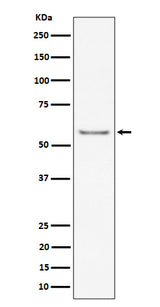 Anti-ICAM2 / CD102 Rabbit Monoclonal Antibody Boster Bio