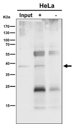 Anti-NSDHL Rabbit Monoclonal Antibody Boster Bio