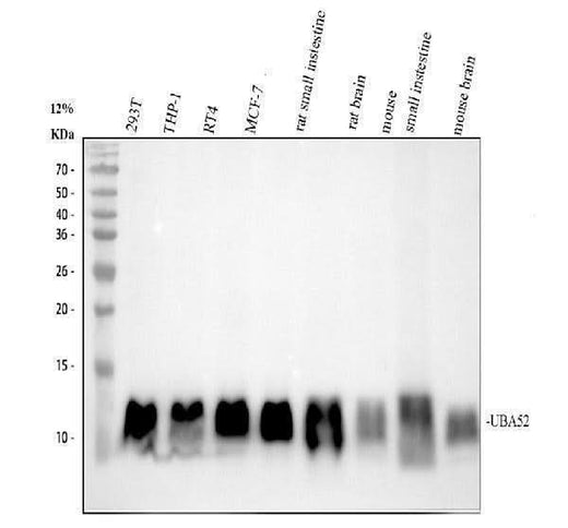 Anti-UBA52 Rabbit Monoclonal Antibody Boster Bio
