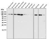 Anti-EXOC2 Rabbit Monoclonal Antibody Boster Bio