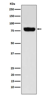 Anti-SLC22A3 Rabbit Monoclonal Antibody Boster Bio