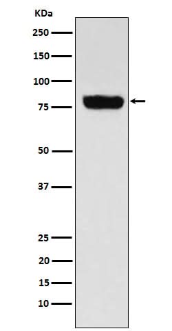 Anti-SLC22A3 Rabbit Monoclonal Antibody Boster Bio