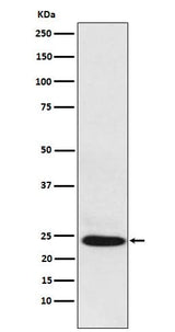 Anti-BAG2 Rabbit Monoclonal Antibody Boster Bio