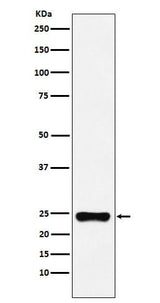Anti-BAG2 Monoclonal Antibody Boster Bio