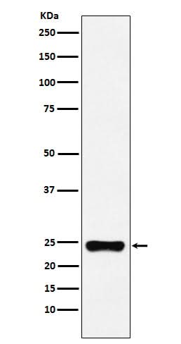 Anti-BAG2 Monoclonal Antibody Boster Bio