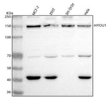 Anti-ORP150 Rabbit Monoclonal Antibody Boster Bio