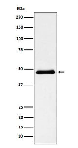 Anti-Pancreatic Lipase (PNLIP) Rabbit Monoclonal Antibody Boster Bio