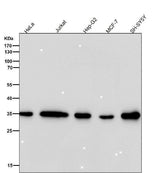 Anti-FRG1 Rabbit Monoclonal Antibody Boster Bio