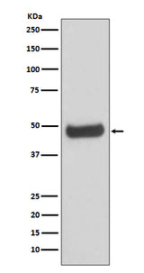 Anti-PKA 2 beta PRKAR2B Rabbit Monoclonal Antibody Boster Bio