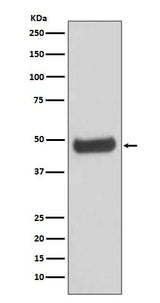Anti-PKA 2 beta PRKAR2B Rabbit Monoclonal Antibody Boster Bio