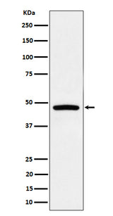 Anti-PREB Rabbit Monoclonal Antibody Boster Bio