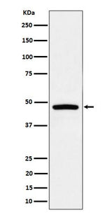 Anti-PREB Rabbit Monoclonal Antibody Boster Bio