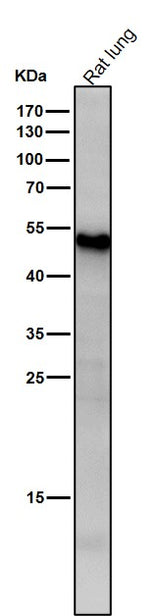 Anti-ATF7 Rabbit Monoclonal Antibody Boster Bio