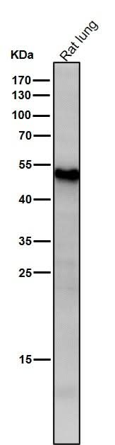 Anti-ATF7 Rabbit Monoclonal Antibody Boster Bio