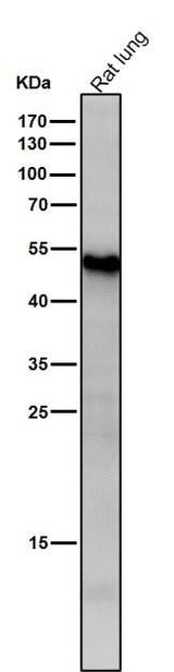 Anti-ATF7 Rabbit Monoclonal Antibody Boster Bio