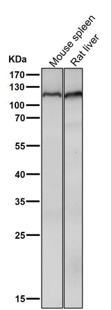 Anti-Mov10 Rabbit Monoclonal Antibody Boster Bio