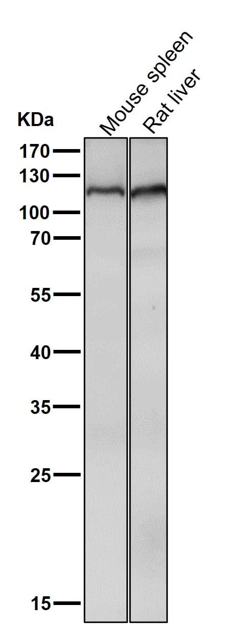 Anti-Mov10 Rabbit Monoclonal Antibody Boster Bio