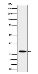 Anti-PSMB10 Rabbit Monoclonal Antibody Boster Bio