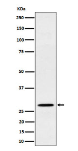 Anti-PSMB10 Rabbit Monoclonal Antibody Boster Bio