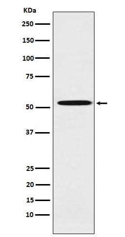 Anti-ALDH1A2 Rabbit Monoclonal Antibody Boster Bio