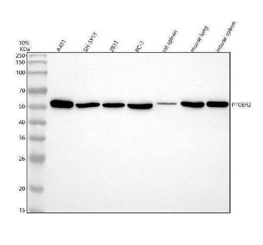 Anti-PTGER2 Monoclonal Antibody Boster Bio