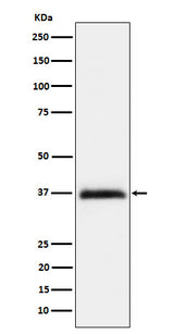 Anti-RGMA Rabbit Monoclonal Antibody Boster Bio