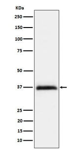 Anti-RGMA Rabbit Monoclonal Antibody Boster Bio