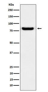Anti-GLU2B Rabbit Monoclonal Antibody Boster Bio