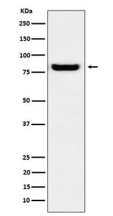 Anti-GLU2B Rabbit Monoclonal Antibody Boster Bio