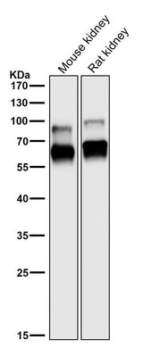 Anti-CRMP1 Rabbit Monoclonal Antibody Boster Bio