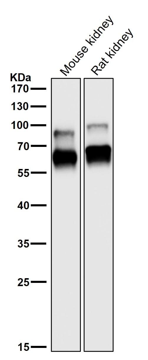 Anti-CRMP1 Rabbit Monoclonal Antibody Boster Bio