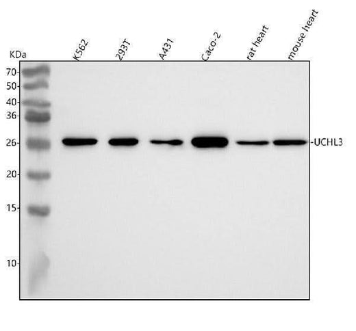 Anti-UCHL3 Rabbit Monoclonal Antibody Boster Bio