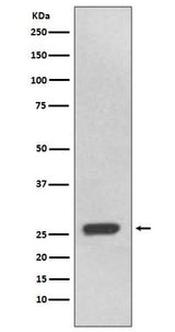 Anti-UCHL3 Rabbit Monoclonal Antibody Boster Bio