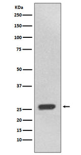 Anti-UCHL3 Rabbit Monoclonal Antibody Boster Bio