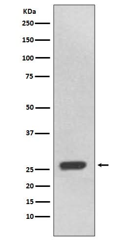 Anti-UCHL3 Rabbit Monoclonal Antibody Boster Bio