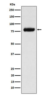 Anti-PLAP Rabbit Monoclonal Antibody Boster Bio
