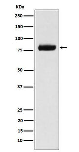 Anti-PLAP Rabbit Monoclonal Antibody Boster Bio