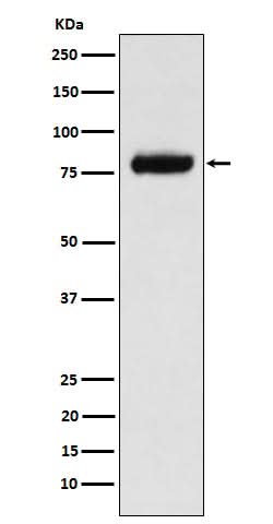 Anti-PLAP Rabbit Monoclonal Antibody Boster Bio