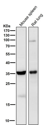 Anti-5HT7 Receptor Rabbit Monoclonal Antibody Boster Bio