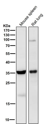 Anti-5HT7 Receptor Rabbit Monoclonal Antibody Boster Bio