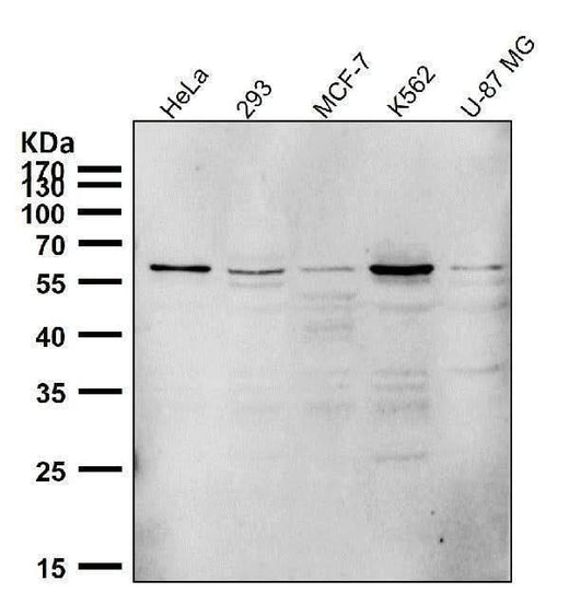 Anti-PTBP2 Rabbit Monoclonal Antibody Boster Bio